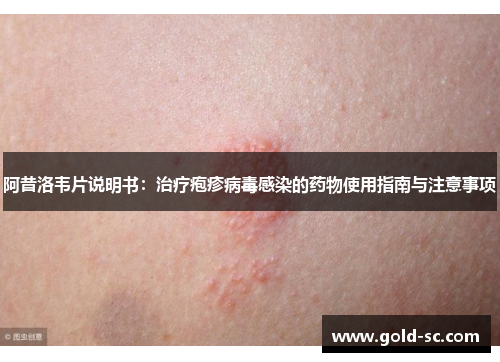 阿昔洛韦片说明书：治疗疱疹病毒感染的药物使用指南与注意事项